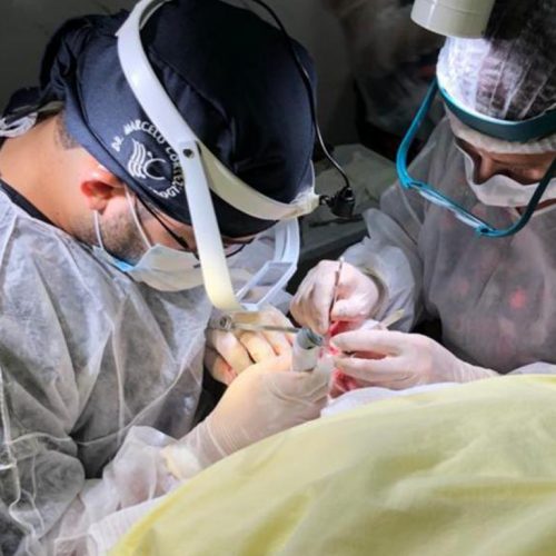 Transplante capilar - dr marcelo cortez 1